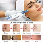 dr. pen a9 ultima microneedling przed i po