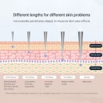 dr. pen microneedling needle length benefit